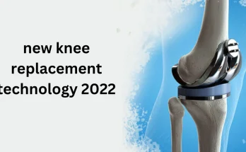new knee replacement technology